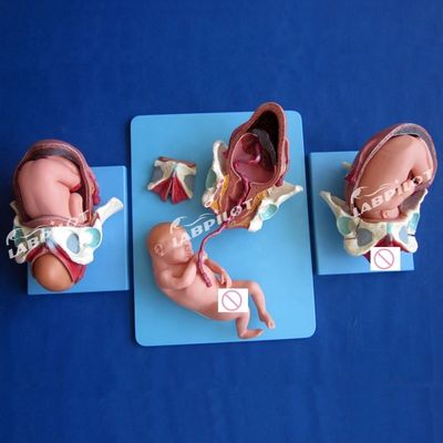 医学解剖学実証モデル 出産 盆腔と満期胎児モデル