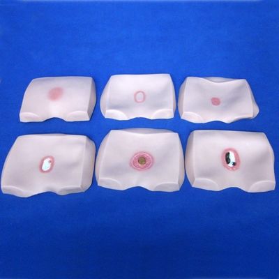 臨床看護師訓練モデル 骨折症の段階 潰瘍 病院の看護