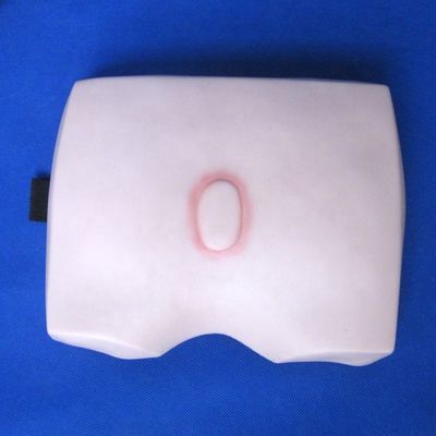 臨床看護師訓練モデル 骨折症の段階 潰瘍 病院の看護