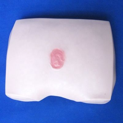 臨床看護師訓練モデル 骨折症の段階 潰瘍 病院の看護