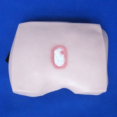 臨床看護師訓練モデル 骨折症の段階 潰瘍 病院の看護