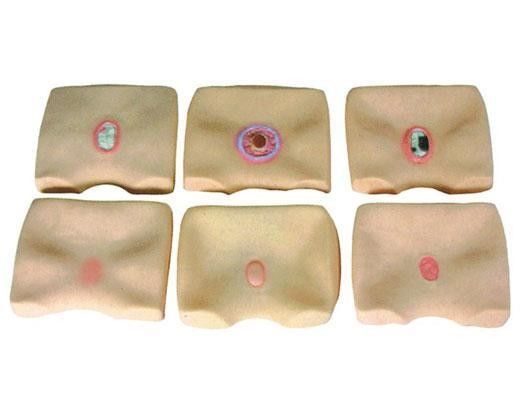 腰部 皮膚 潰瘍 シミュレーター 病院 用 床痛 介護 訓練 を 改善 する